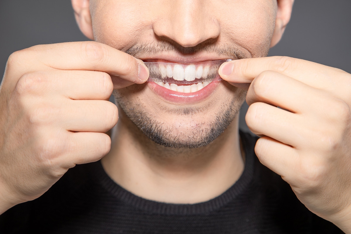 How professional whitening compares to at home whitening kits blog