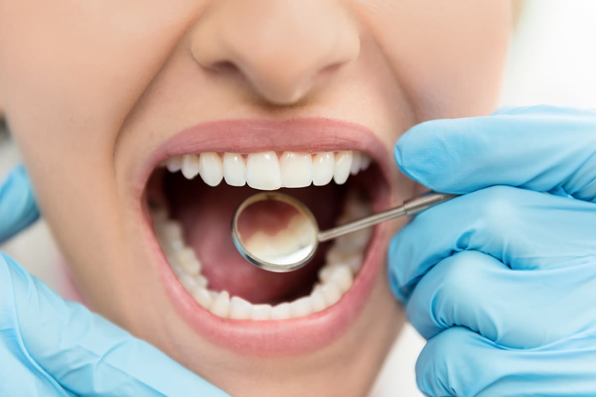 How to choose the right dentist in your city for long term oral health blog